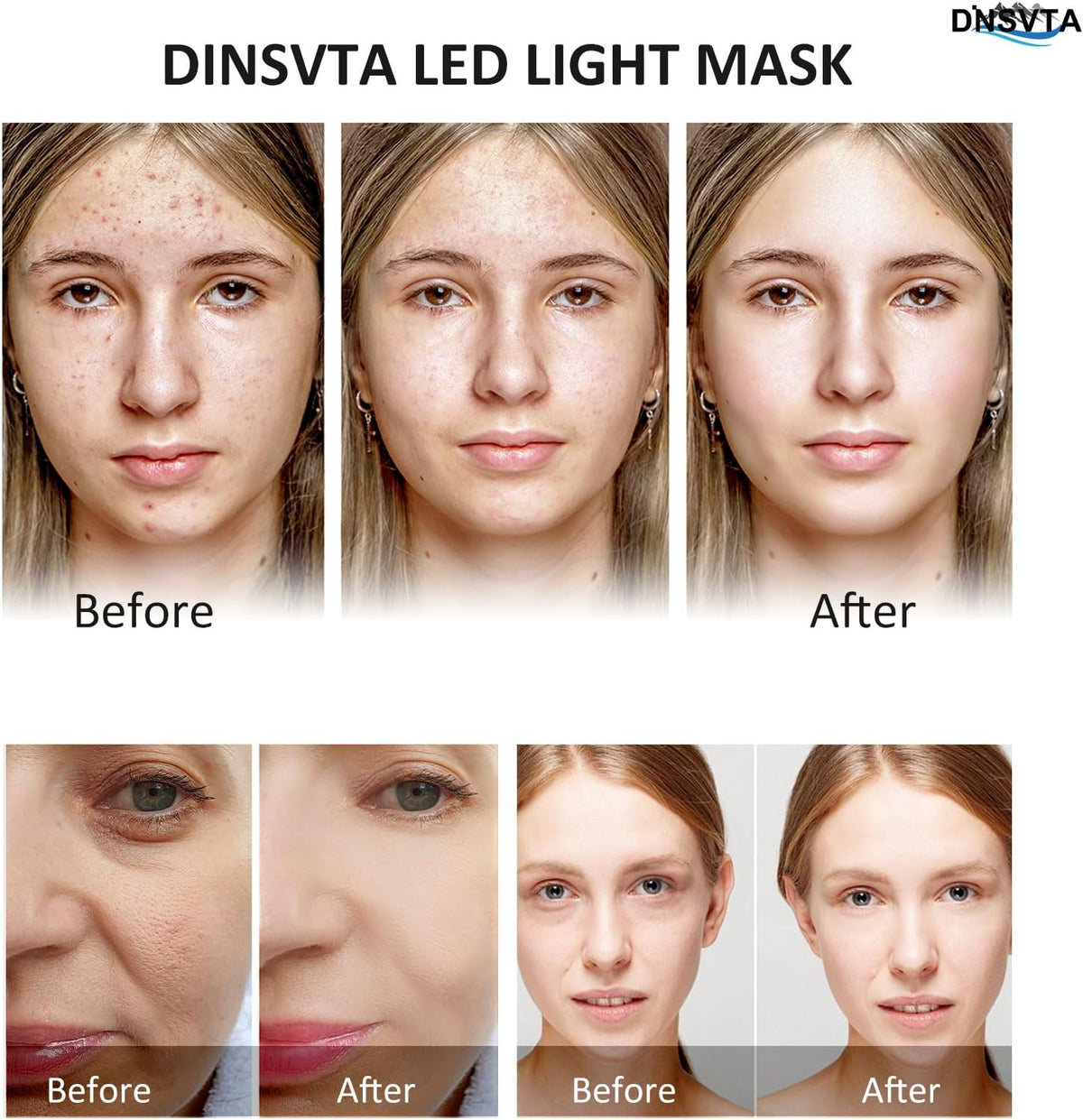 Before and after results using the DINSVTA LED light mask showcasing skin improvement, highlighting LED face mask benefits.